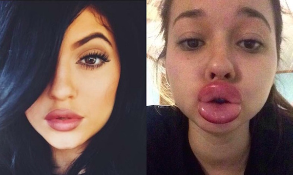 カイリー・ジェンナー・チャレンジ #KylieJennerChallengeに関連した画像-05