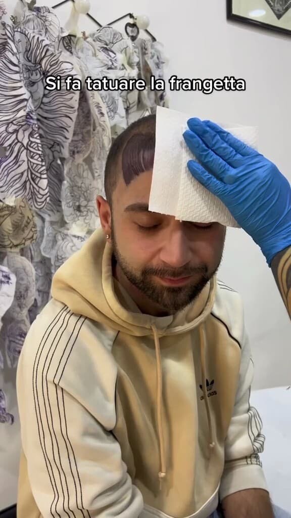 イタリア　ヘアタトゥー　タトゥー　ハゲ　薄毛